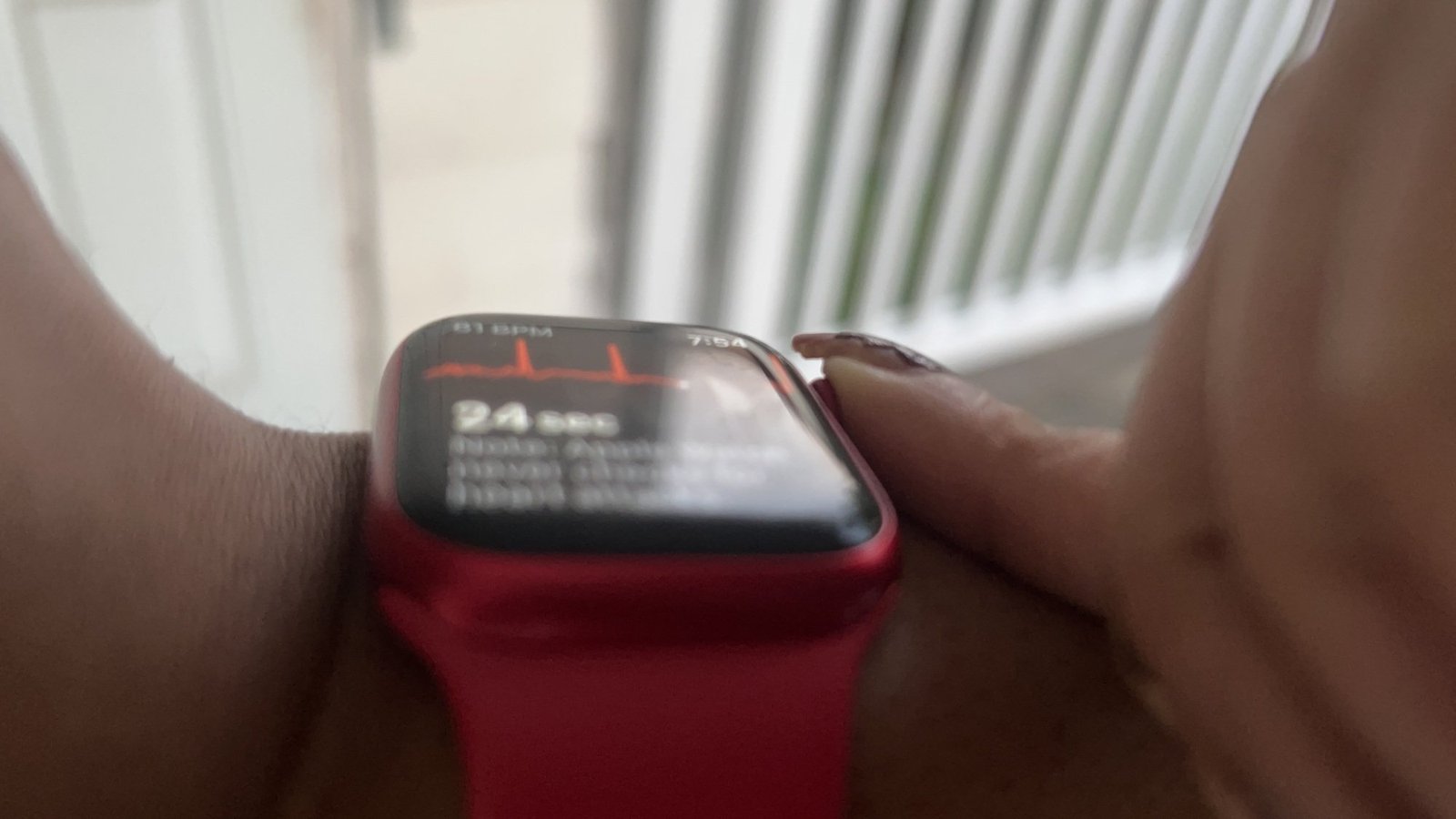 ECG no Apple Watch Series 9
